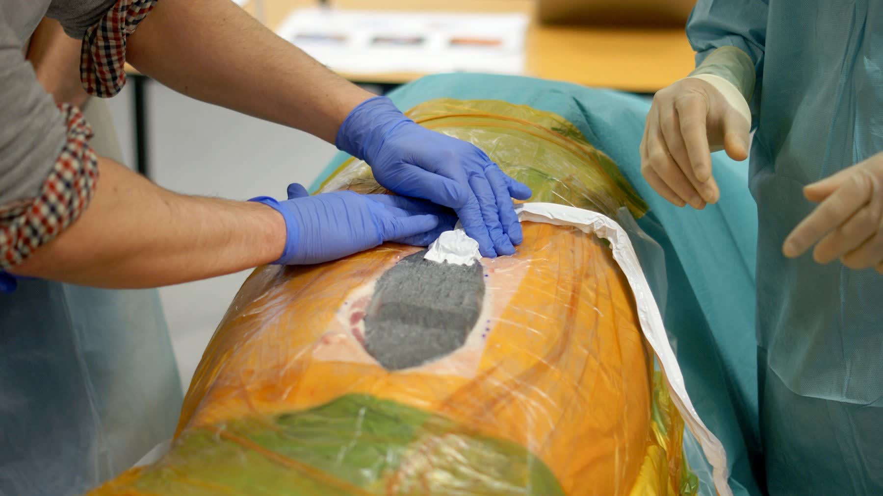 Surgeons applying abdominal closure device on simulation model